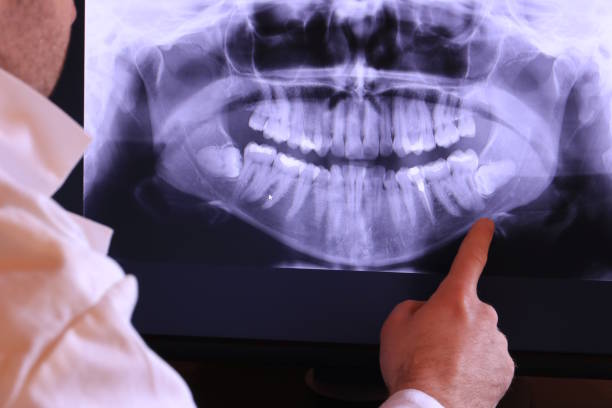 Best Cosmetic Emergency Dentistry in Madeira Beach, FL